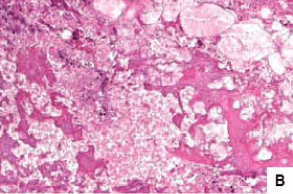 Μικροσκοπική εικόνα νησιδιακών κυττάρων