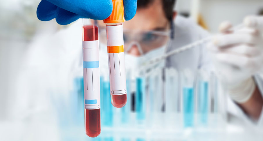  Αιματολογικές εξετάσεις