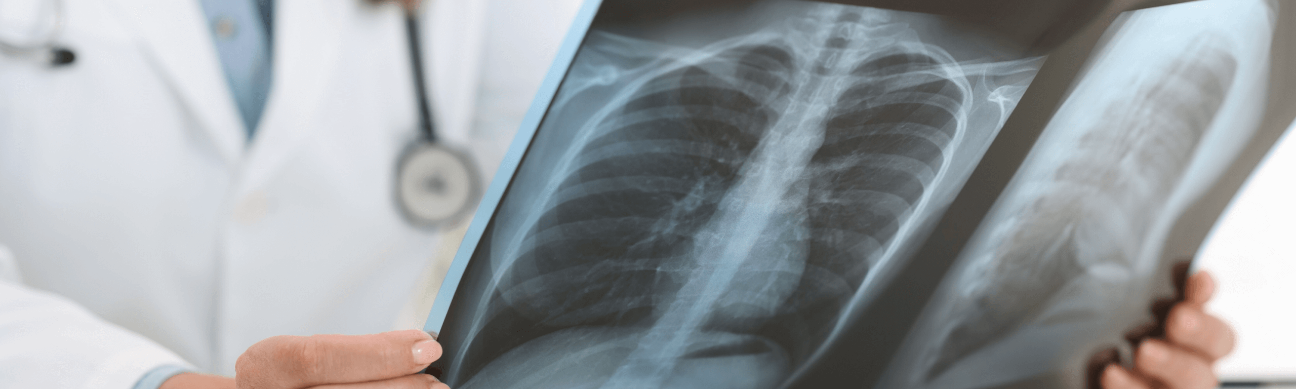 Ακτινολογία Ιατρική Απεικόνιση