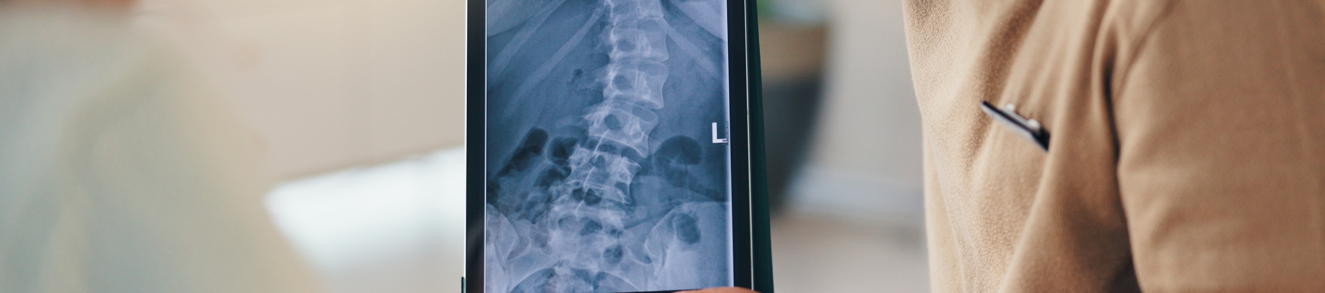 Το μέλλον της χειρουργικής της σπονδυλικής στηλης