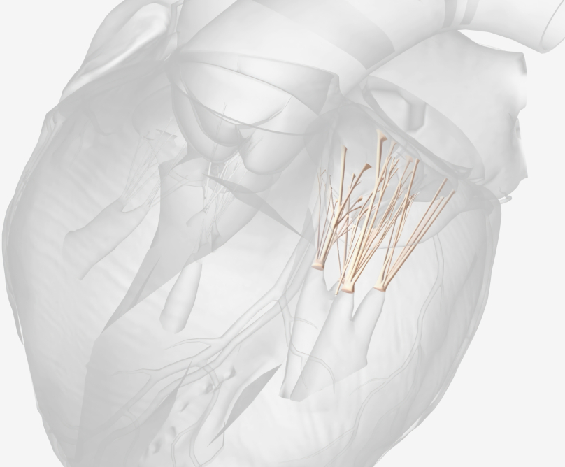 MitraClip: Πρωτοποριακή Διαδερμική Επιδιόρθωση Ανεπάρκειας Μιτροειδούς Βαλβίδας
