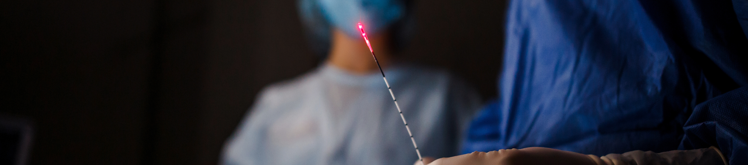 Οριστική και ανώδυνη αντιμετώπιση των κιρσών με laser