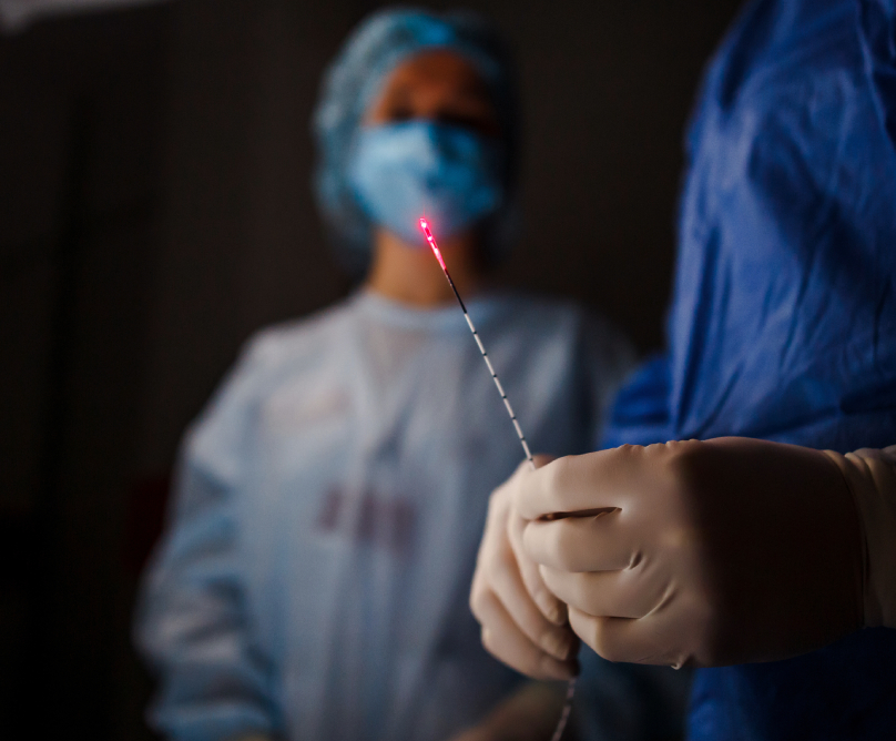 Οριστική και ανώδυνη αντιμετώπιση των κιρσών με laser