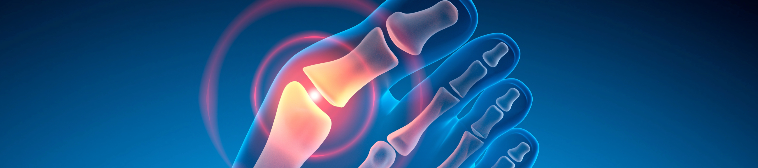 Βλαισός Μέγας Δάκτυλος (Κότσι): αιτίες και θεραπείες