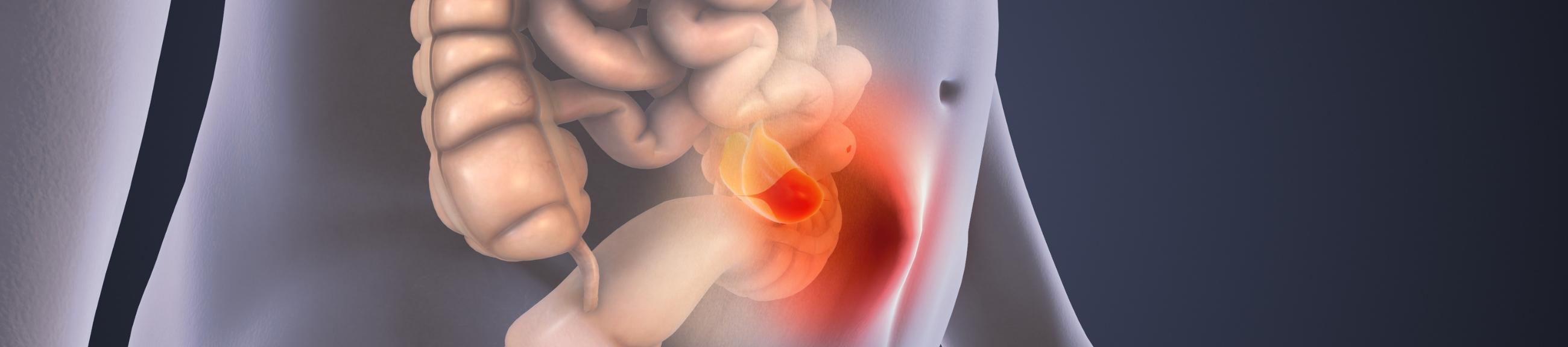 Ρομποτική θεραπεία κήλης: άψογο αποτέλεσμα, χωρίς σημάδια και ουλές