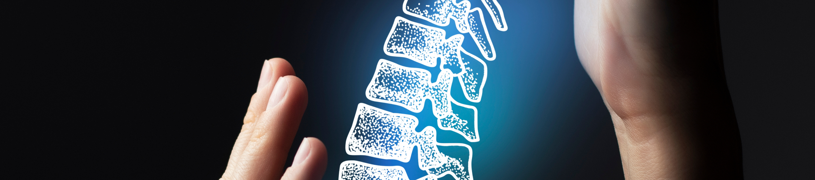 Τα πλεονεκτήματα της χειρουργικής αντιμετώπισης της σκολίωσης και της κύφωσης με το ρομποτικό σύστημα ExcelsiusGPS