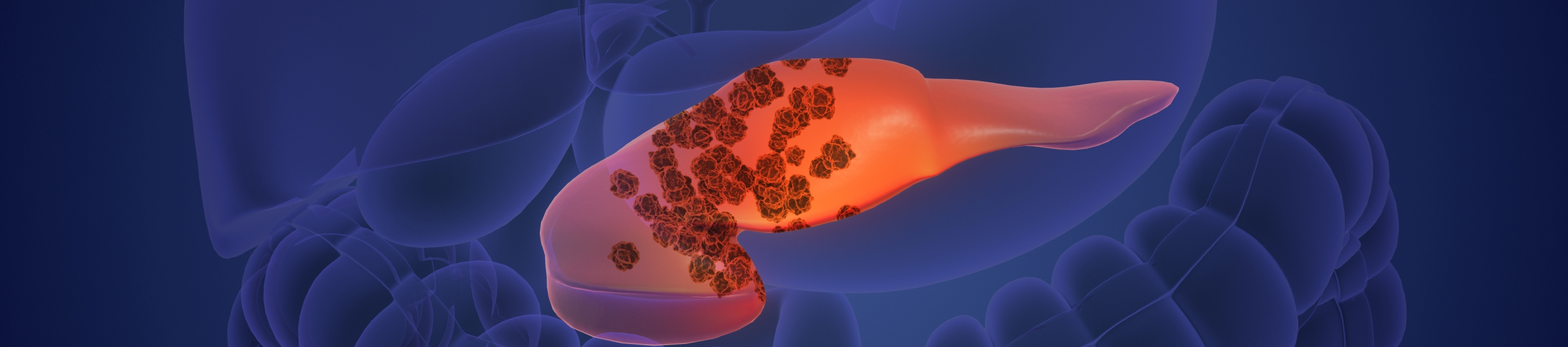 Παγκόσμια Ημέρα του Καρκίνου του Παγκρέατος