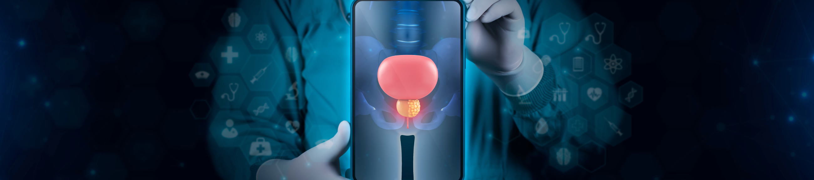 Διάγνωση στον καρκίνο του προστάτη