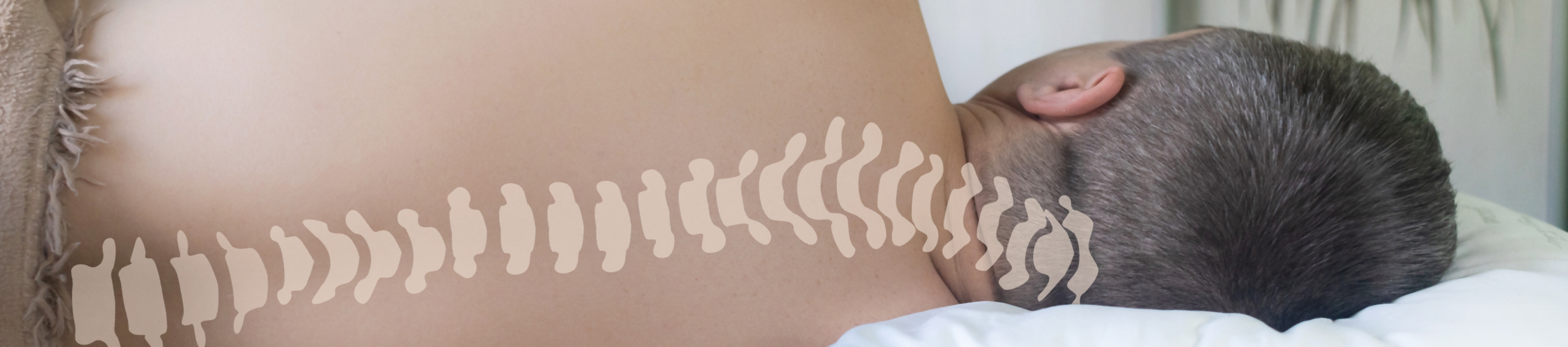 Χειρουργική Θεραπεία Σκολίωσης Ενηλίκων