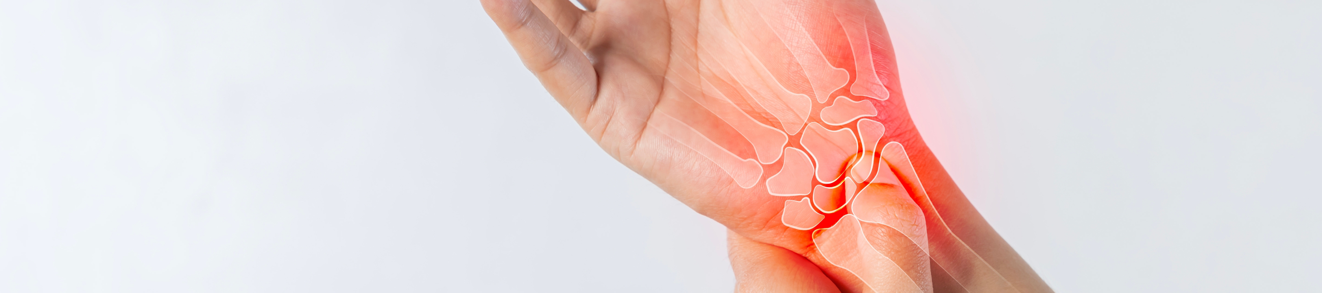 Ρήξη τρίγωνου χόνδρου: μια συχνή αιτία πόνου στον καρπό που χρειάζεται να ελεγχθεί από ειδικό ορθοπαιδικό