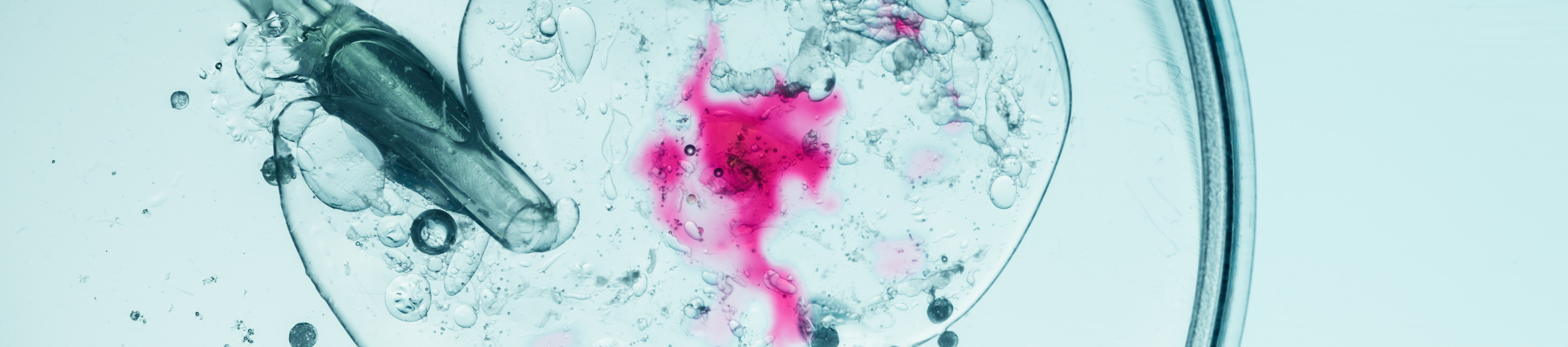 Εξωσωματική γονιμοποίηση