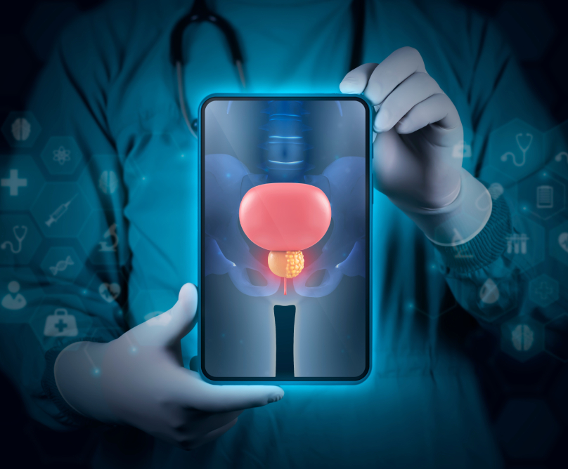 Διάγνωση στον καρκίνο του προστάτη