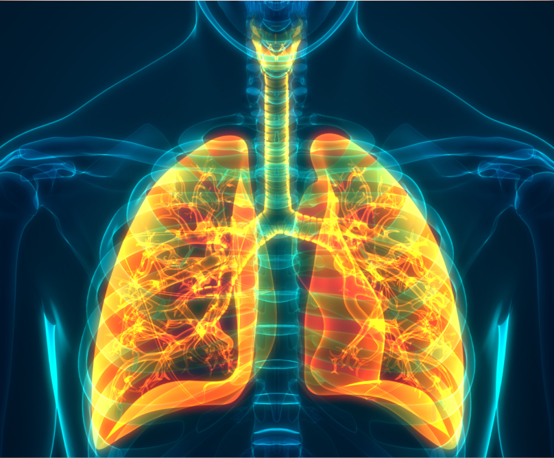 Χρόνια Αποφρακτική Πνευμονοπάθεια