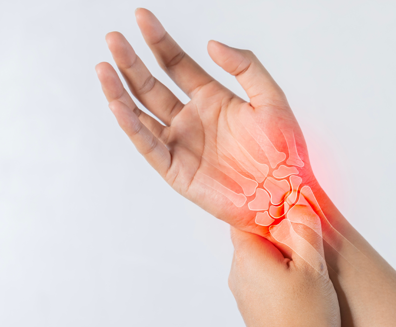 Ρήξη τρίγωνου χόνδρου: μια συχνή αιτία πόνου στον καρπό που χρειάζεται να ελεγχθεί από ειδικό ορθοπαιδικό