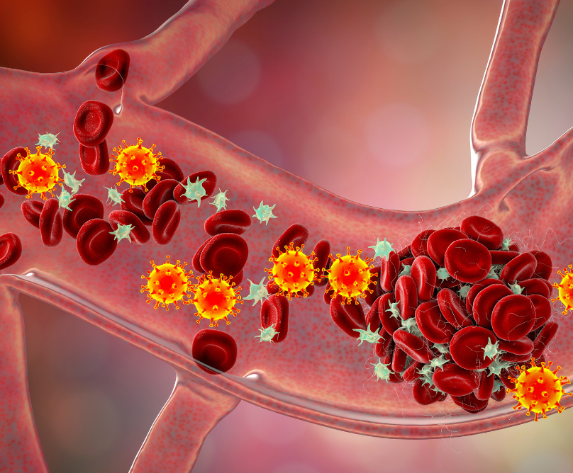 Aυξάνει η νόσος COVID-19 τον κίνδυνο θρόμβωσης;