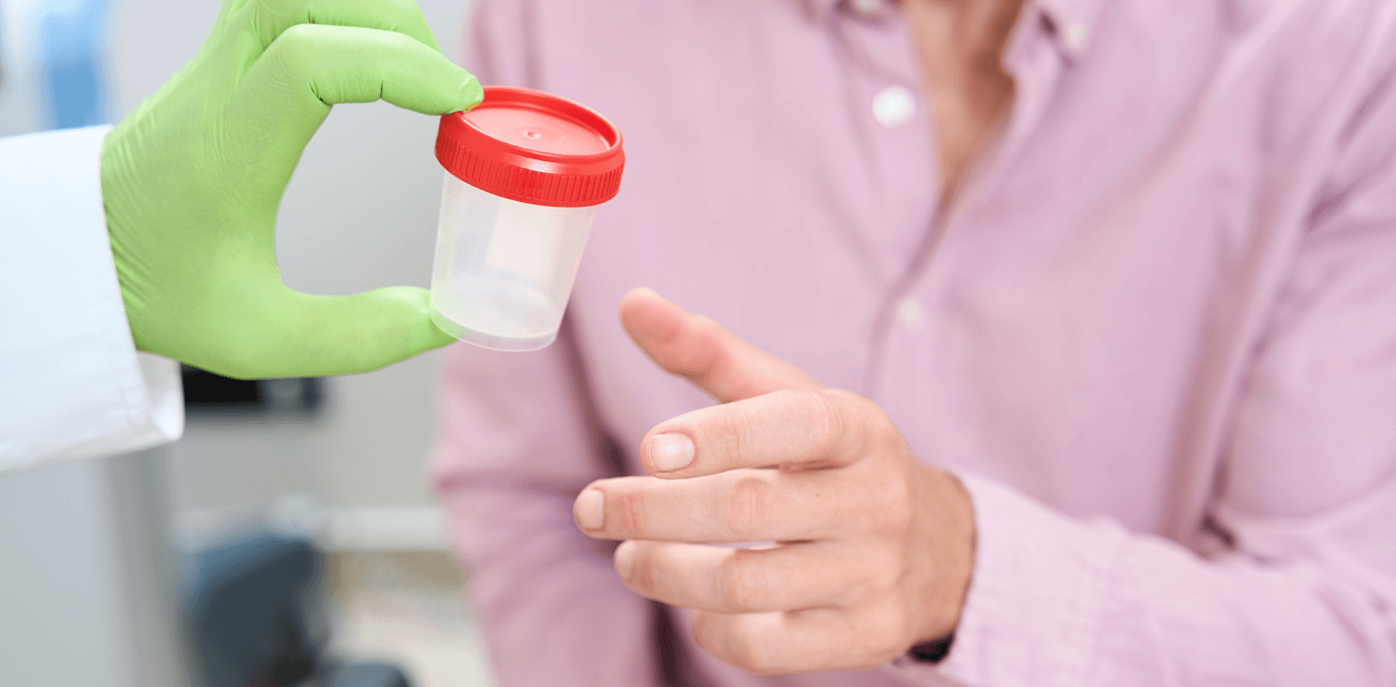 Εξετάσεις Ούρων