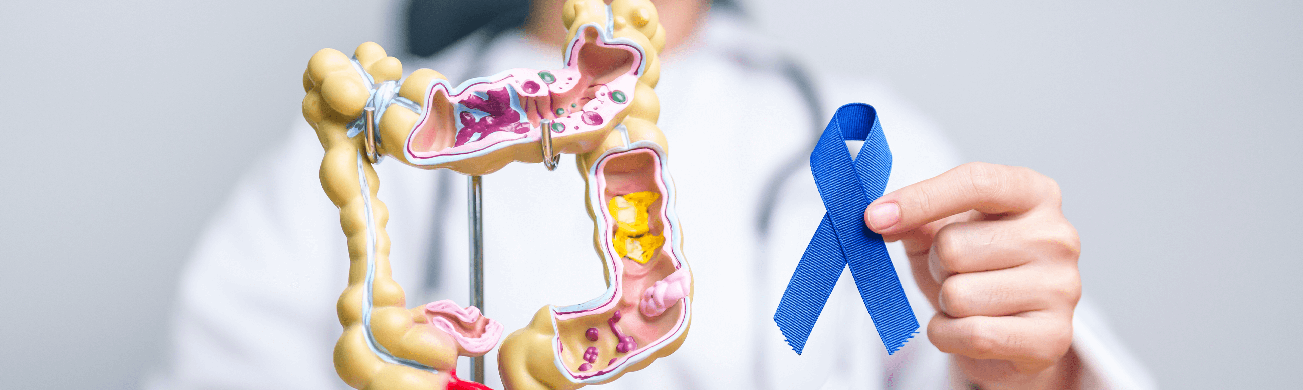 Καρκίνος Ορθού