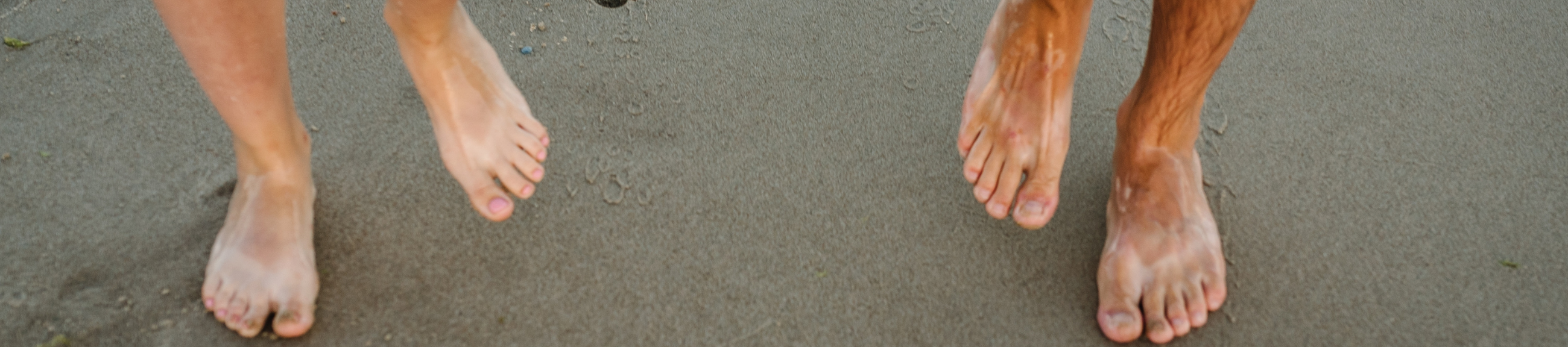 Σακχαρώδης διαβήτης & καλοκαίρι: ειδική φροντίδα για τα πόδια