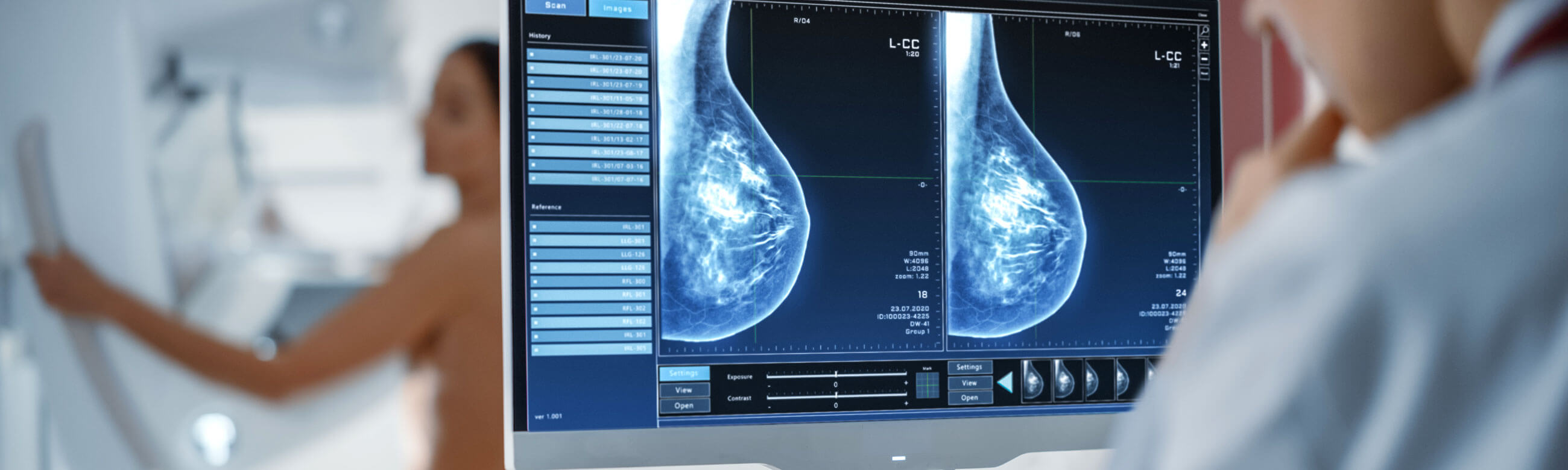 Ψηφιακός μαστογράφος, τελευταίας τεχνολογίας, Hologic - Selenia