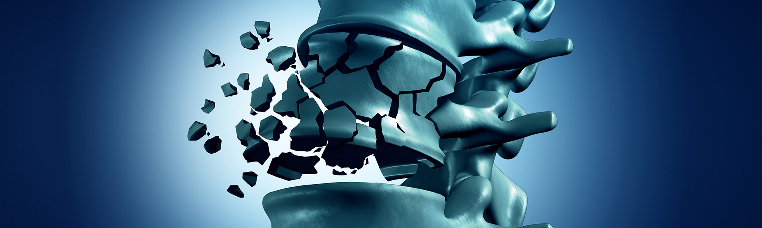 Οστεοπόρωση